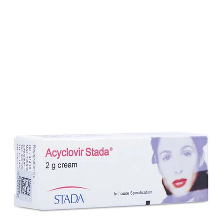 Kem bôi Acyclovir giúp ức chế virus tại chỗ, hỗ trợ nốt thủy đậu mau lành