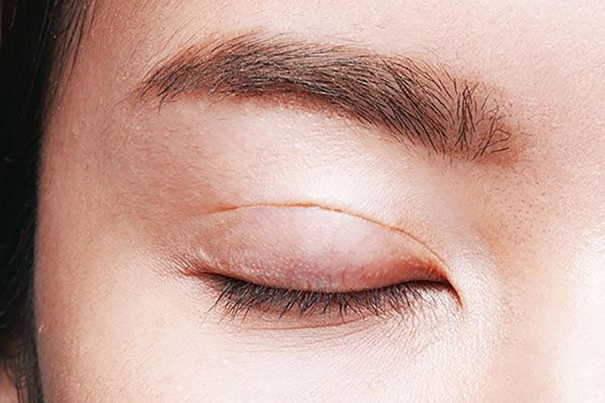 NHẤN MÍ BAO LÂU THÌ HẾT SƯNG RÕ RỆT