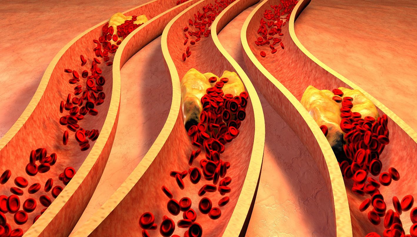 Thuốc mỡ máu tập trung vào việc hạ cholesterol trong dòng máu chứ không giúp đốt cháy mỡ thừa dưới da 