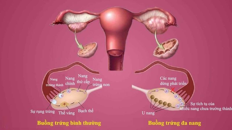 Chế độ dinh dưỡng lành mạnh đóng vai trò quan trọng trong việc phục hồi sức khỏe sau kỳ kinh kéo dài