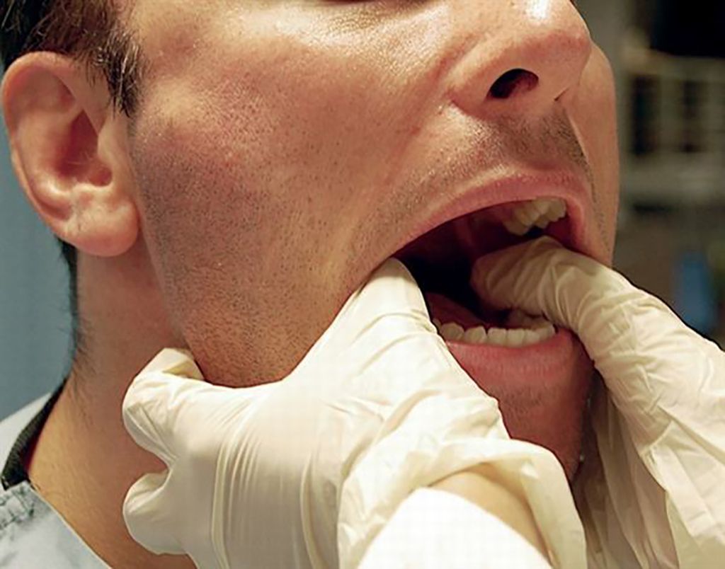 Đau nhức vùng hàm khiến các hoạt động ăn uống và giao tiếp gặp nhiều trở ngại 