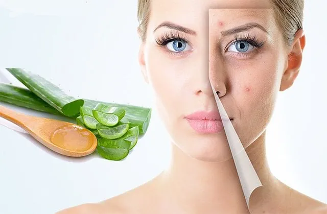 Mụn sưng đỏ thường xuất hiện khi nang lông bị viêm và tích tụ vi khuẩn