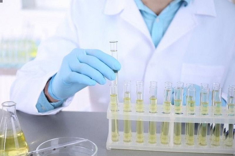 Lựa chọn các sản phẩm hỗ trợ tiết niệu uy tín giúp bảo vệ chức năng màng lọc cầu thận 