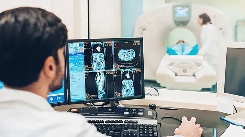 Chụp MRI là kỹ thuật chẩn đoán hình ảnh hiện đại giúp quan sát chi tiết cấu trúc cột sống