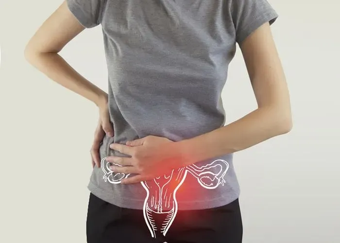 Cơn đau vùng bụng dưới có thể xuất hiện khi nang buồng trứng bị xuất huyết