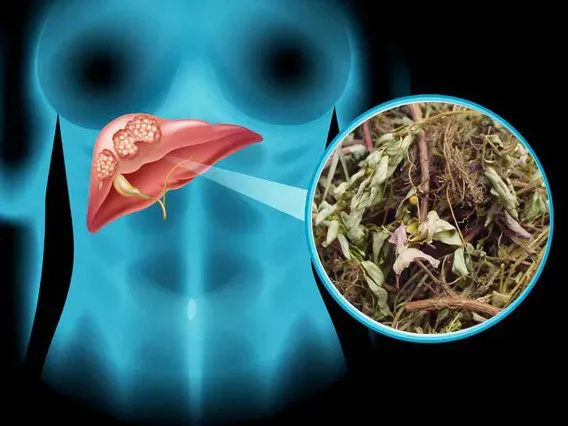 Chó đẻ răng cưa khô được dùng để sắc nước uống giải độc gan (Nguồn: Sưu tầm)