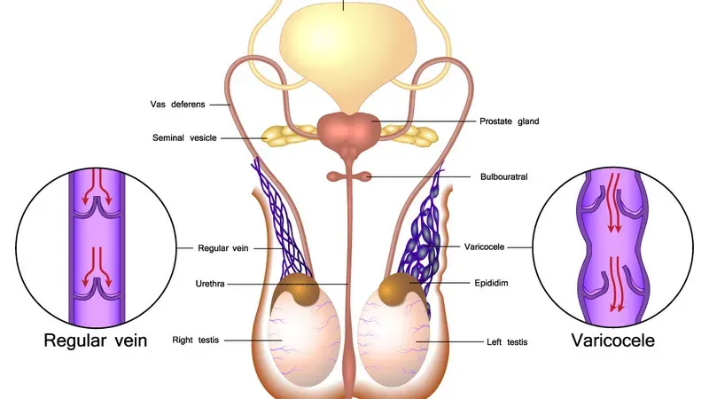 Phẫu thuật có thể giúp cải thiện tình trạng giãn tĩnh mạch thừng tinh