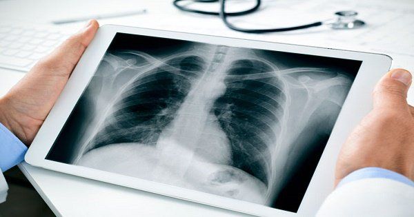 Liệu pháp oxy hỗ trợ người bệnh duy trì hoạt động và cải thiện chất lượng cuộc sống