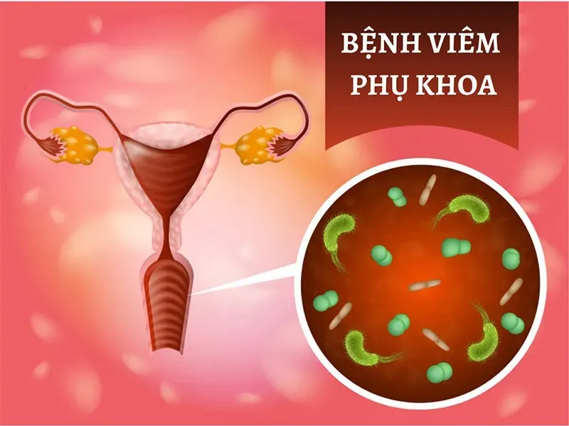 Viêm nhiễm phụ khoa có thể khiến niêm mạc tổn thương và gây ra máu bất thường 