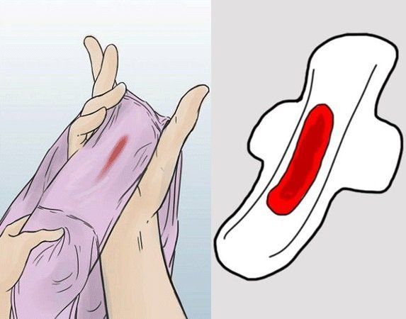 Chảy máu âm đạo bất thường là dấu hiệu quan trọng cần được thăm khám kịp thời