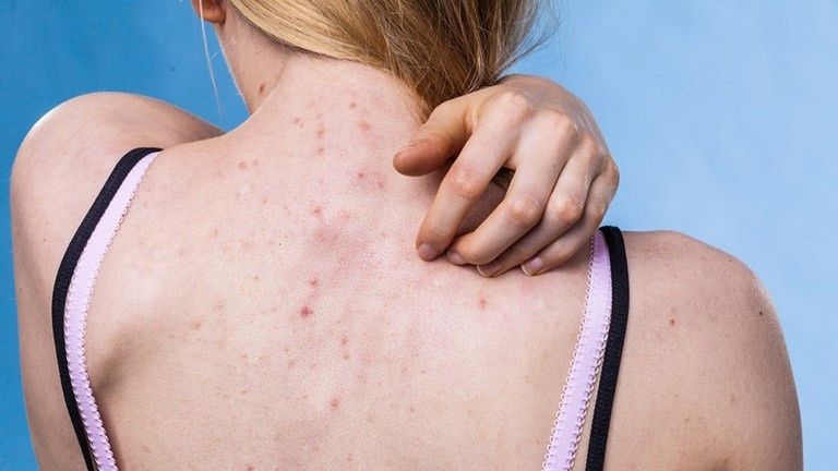 Hãy chú ý lắng nghe các biểu hiện bất thường của cơ thể để kịp thời điều chỉnh liều lượng thuốc