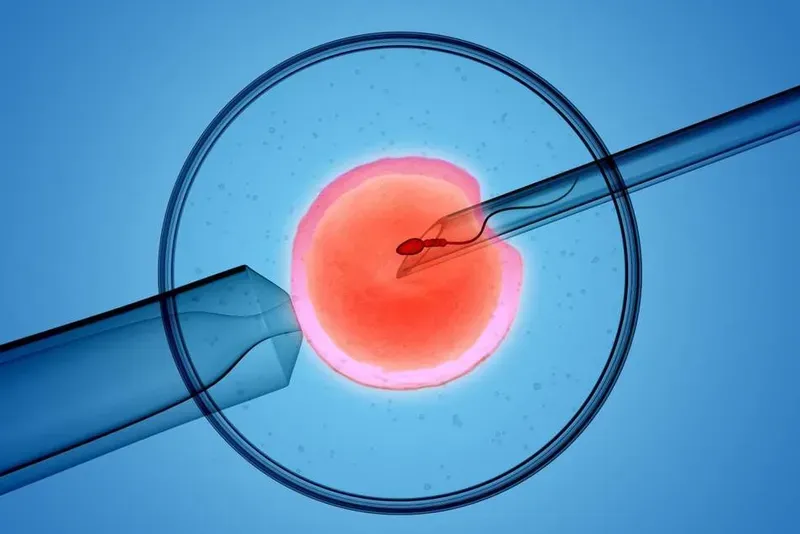 Thụ tinh ống nghiệm (IVF)