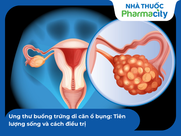 DI CĂN UNG THƯ HẠCH Ổ BỤNG ĐE DỌA NGHIÊM TRỌNG ĐẾN SỨC KHỎE NGƯỜI BỆNH