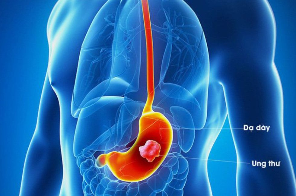 Các phương pháp chẩn đoán giúp bác sĩ đánh giá tình trạng tổn thương dạ dày ở trẻ 