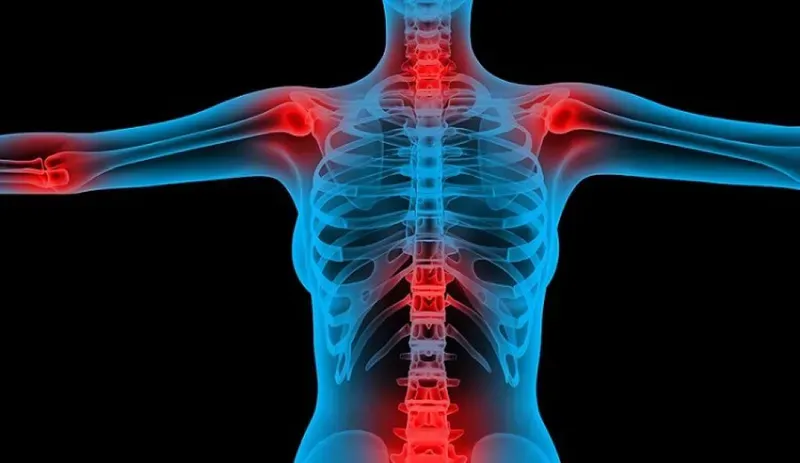 Việc phát hiện ung thư xương ở giai đoạn sớm đóng vai trò quyết định đến hiệu quả điều trị 