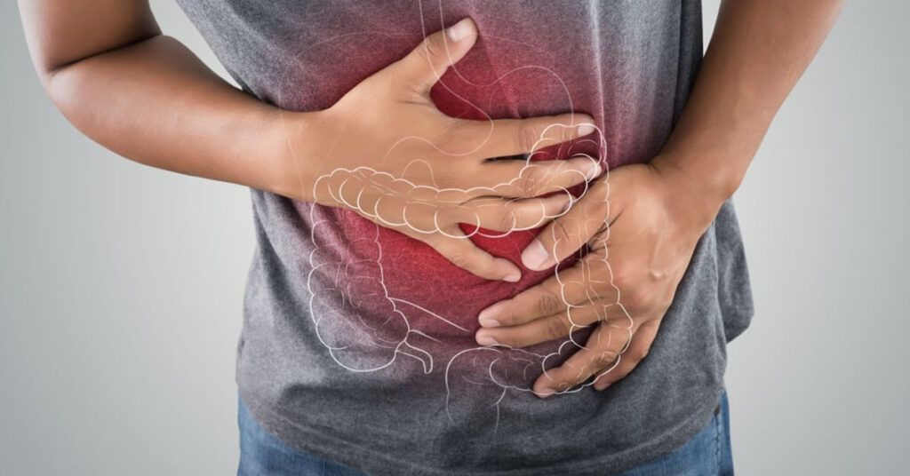 Một lối sống lành mạnh kết hợp với thăm khám y khoa định kỳ là giải pháp bảo vệ đại tràng bền vững nhất