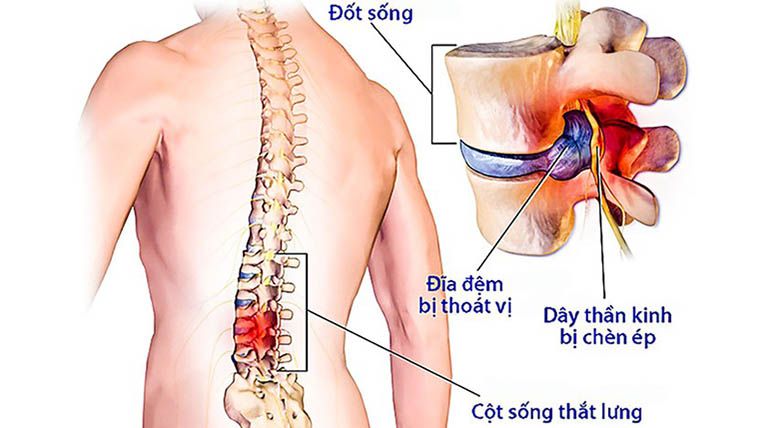 Hình minh hoạ massage huyệt