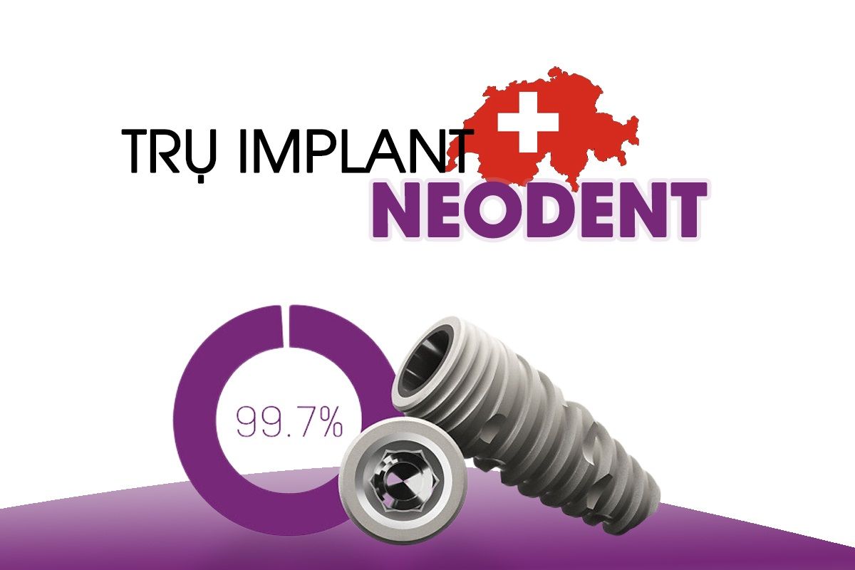 Trụ Implant Neodent Thụy Sĩ – Giải pháp hoàn hảo cho phục hình răng mất