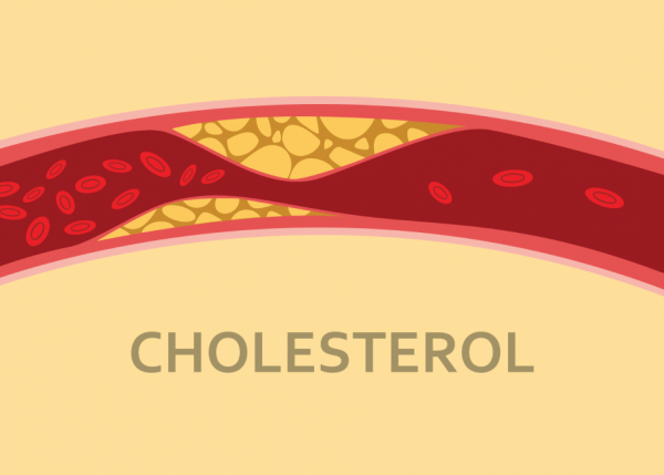 Thấu hiểu các chỉ số cholesterol giúp bạn phòng ngừa hiệu quả các bệnh lý tim mạch nguy hiểm 
