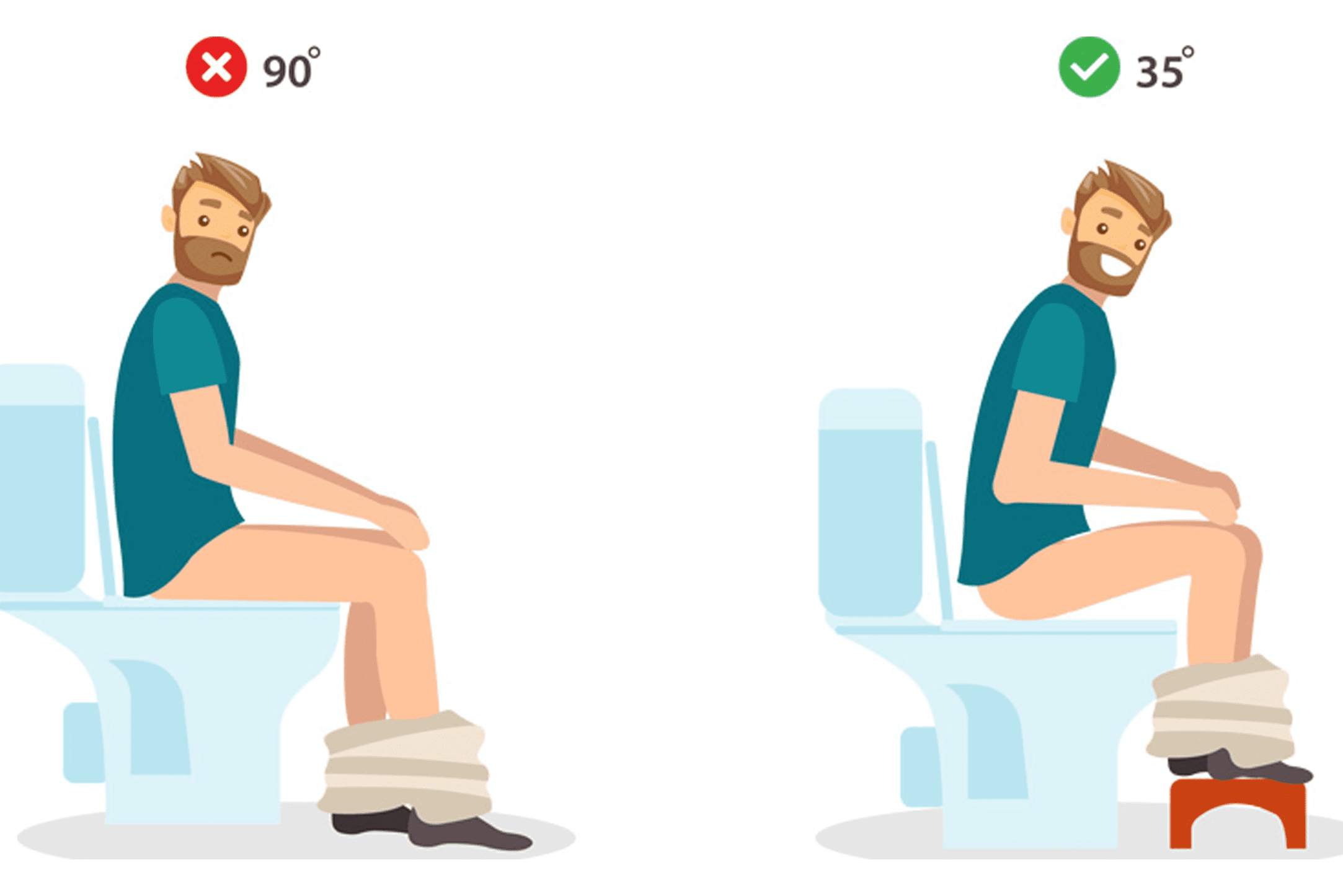 Thay đổi tư thế ngồi vệ sinh giúp thư giãn cơ trực tràng và đi ngoài dễ dàng hơn 