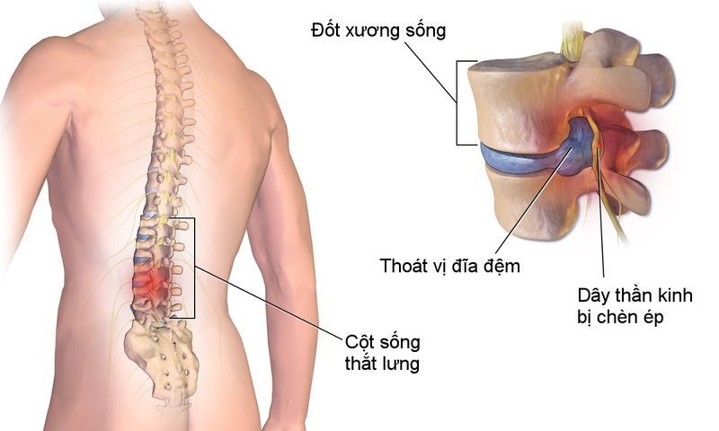 Minh hoạ về cấu trúc cột sống