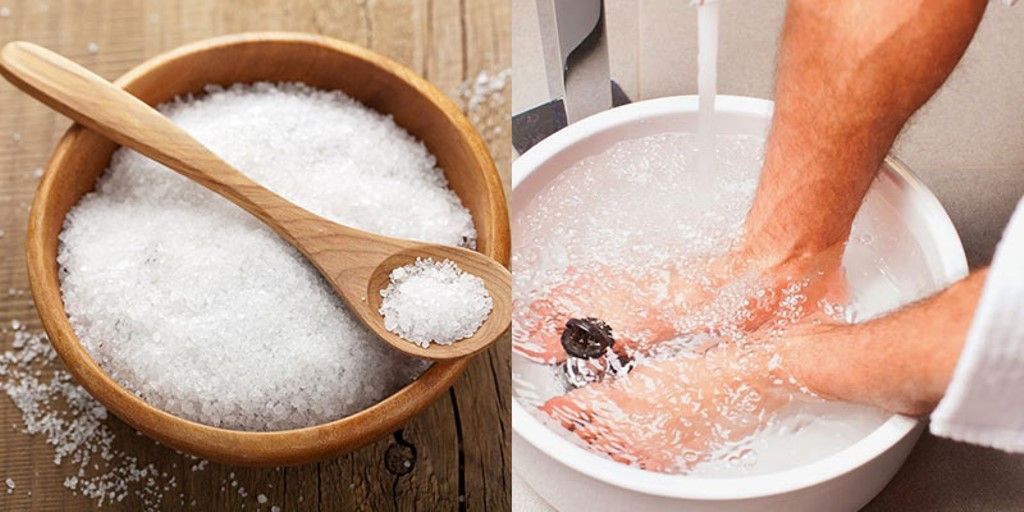 Tuyến mồ hôi giúp cơ thể điều hòa nhiệt độ và bài tiết một số chất điện giải