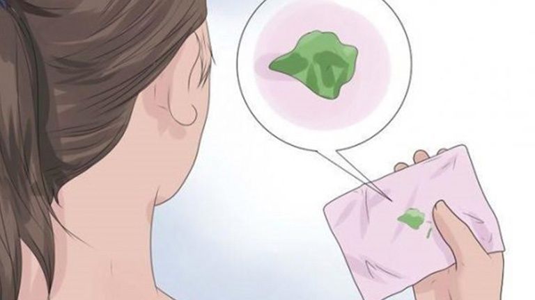 Mùi hôi khó chịu kèm theo huyết trắng là dấu hiệu cảnh báo nhiễm nấm candida