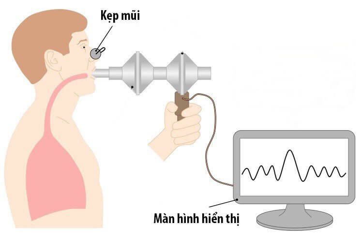 Một số triệu chứng của COPD