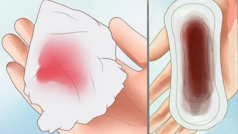 Minh hoạ về chảy máu cam