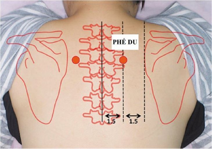 Bấm huyệt là liệu pháp Đông y giúp tăng cường khả năng đào thải mỡ của gan 