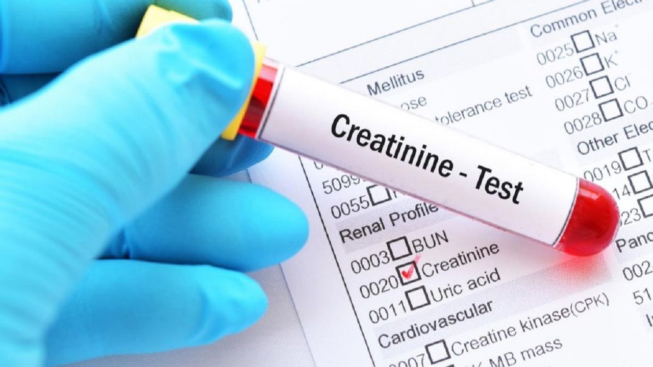 Hình ảnh minh họa xét nghiệm máu giúp đánh giá chỉ số creatinin. 