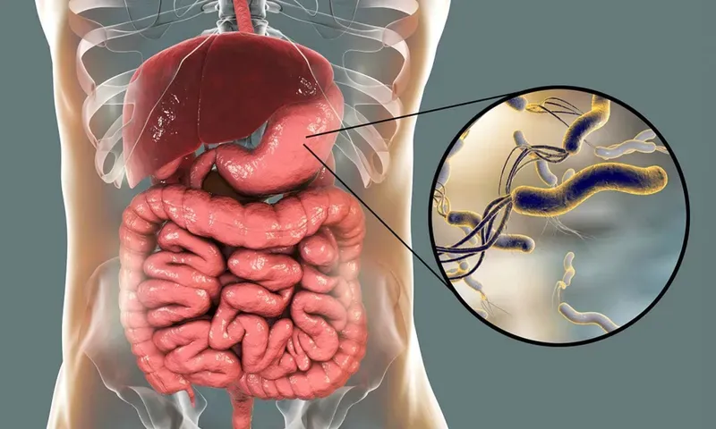 Thói quen ăn uống dùng chung đồ dùng cá nhân là nguyên nhân chính gây lây nhiễm vi khuẩn HP 