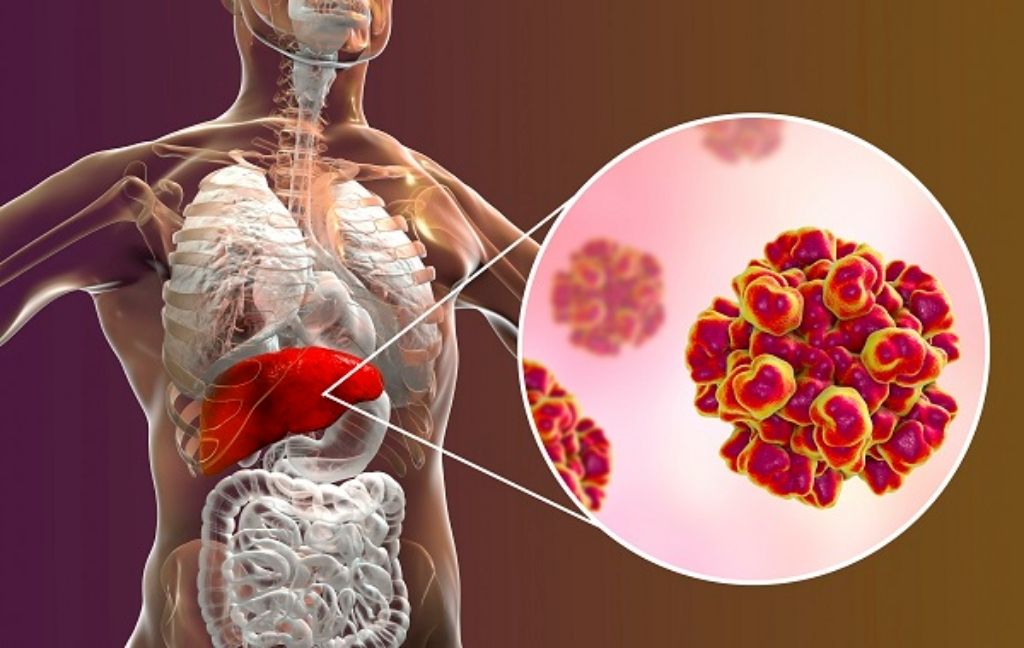 Tầm soát định kỳ giúp phát hiện sớm viêm gan virus mạn để điều trị hiệu quả 