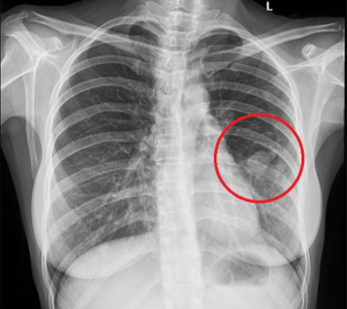 Kiểm tra các chỉ số sinh tồn hỗ trợ đánh giá ban đầu cho bệnh nhân COPD