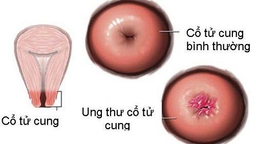 Kiểm tra sức khỏe định kỳ giúp kịp thời phát hiện và giảm nguy cơ bệnh tật