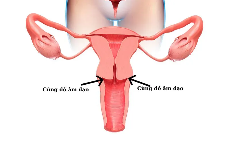 Cùng đồ là phần sâu của âm đạo nằm xung quanh cổ tử cung
