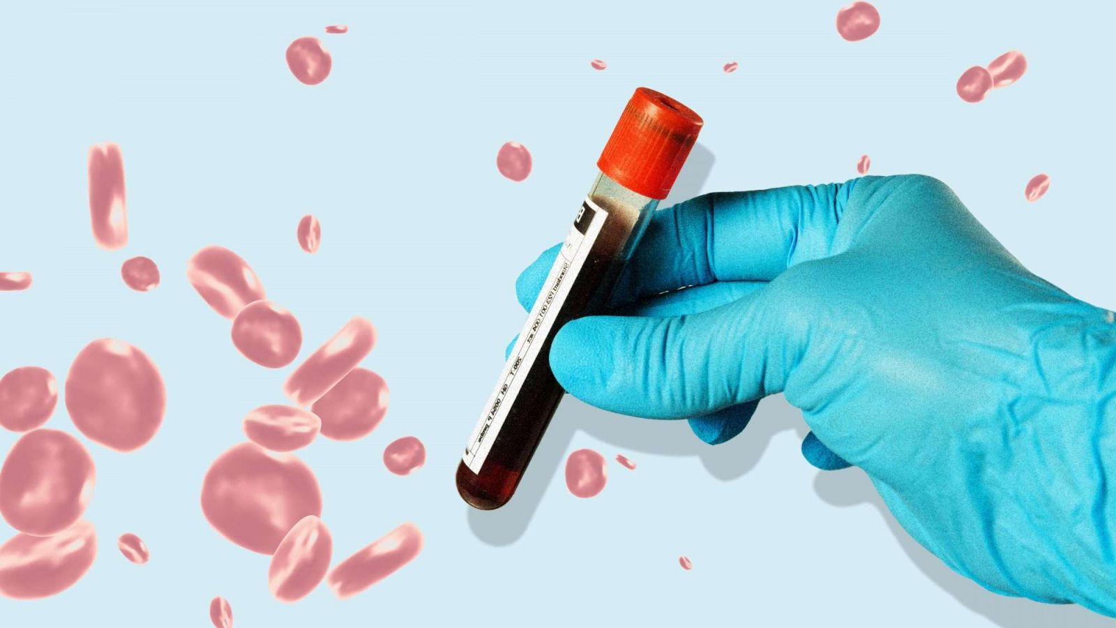 Hình minh họa chi phí xét nghiệm HbA1c