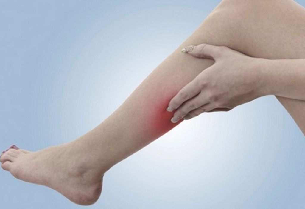 Căng cơ bắp chân gây ra tình trạng sưng đau và khó khăn khi thực hiện động tác kiễng chân
