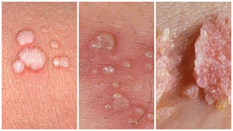 Việc theo dõi các biểu hiện bất thường của cơ thể giúp kiểm soát tốt các tác dụng phụ tại chỗ