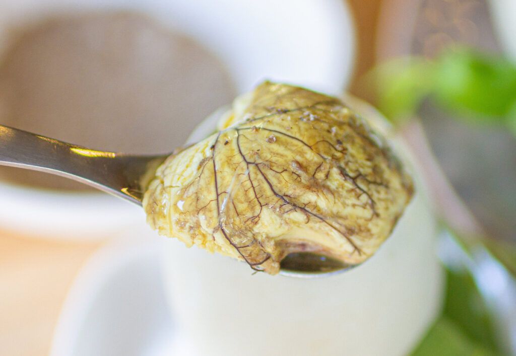 Người bệnh nên ưu tiên các nguồn đạm lành mạnh thay vì thực phẩm giàu cholesterol
