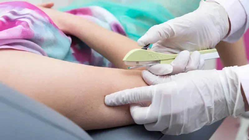 Tác dụng phụ của que tránh thai phụ thuộc vào tùy cơ địa mỗi người