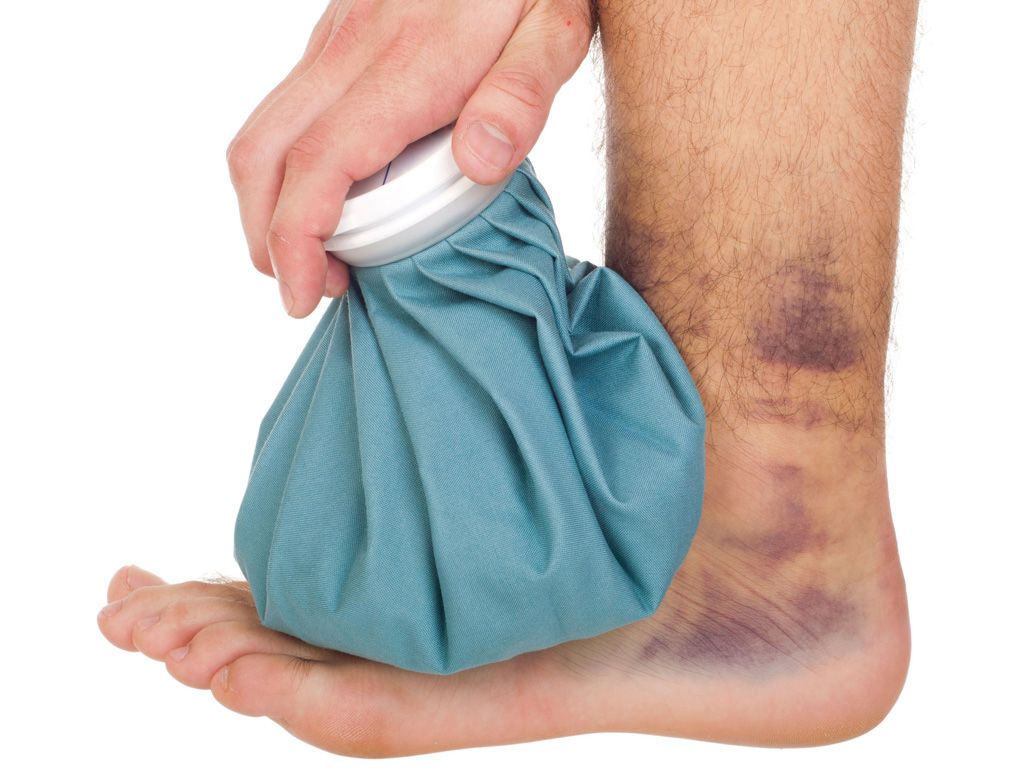 Cách tan máu bầm không cần dùng thuốc tại nhà đúng cách 