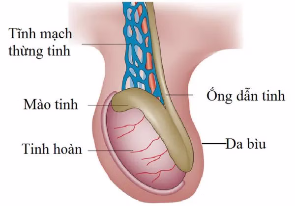 Hình minh họa siêu âm giúp phát hiện và đánh giá mức độ giãn tĩnh mạch thừng tinh