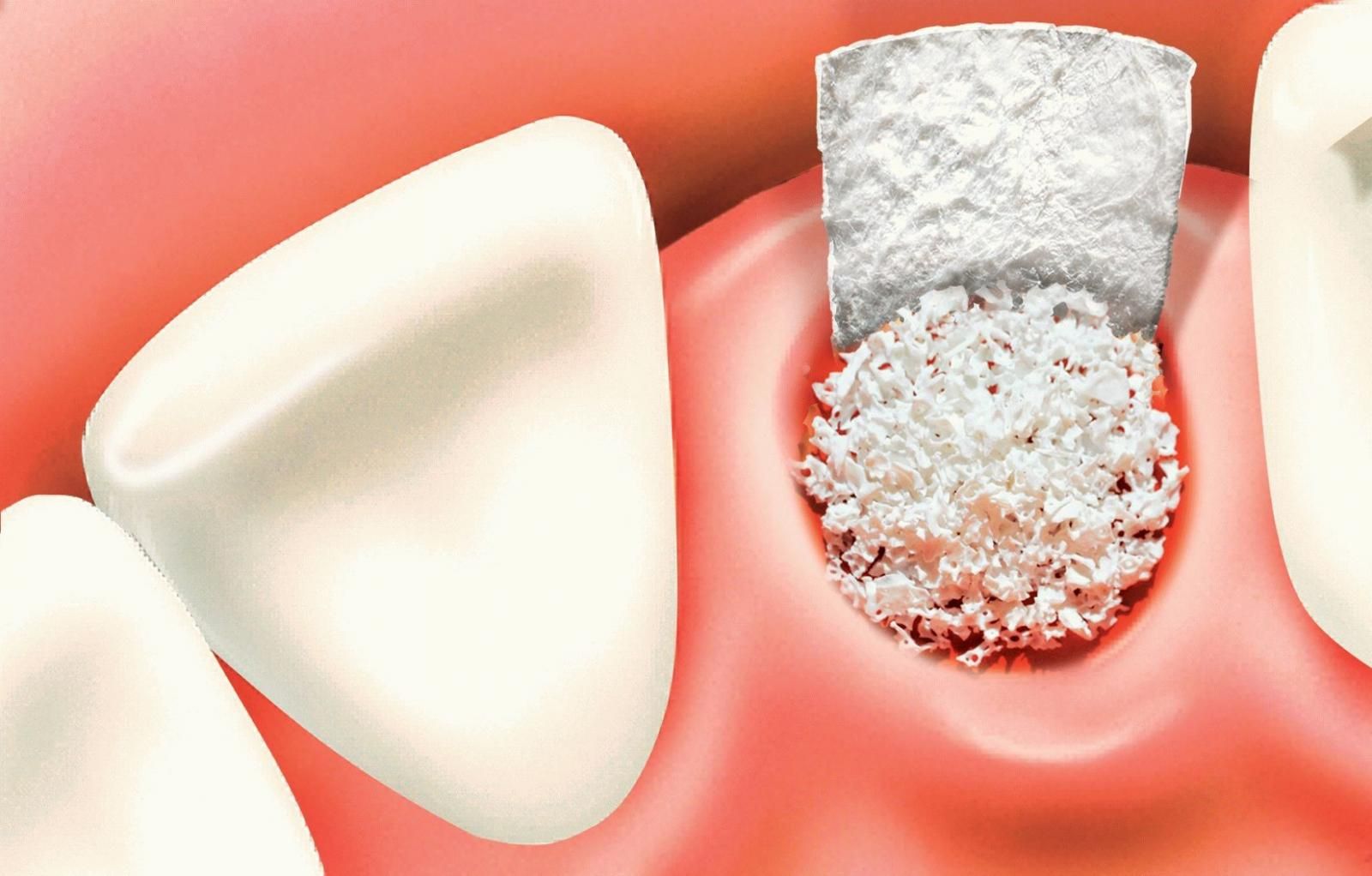 Chăm sóc răng miệng đúng cách giúp hạn chế tình trạng ê buốt răng