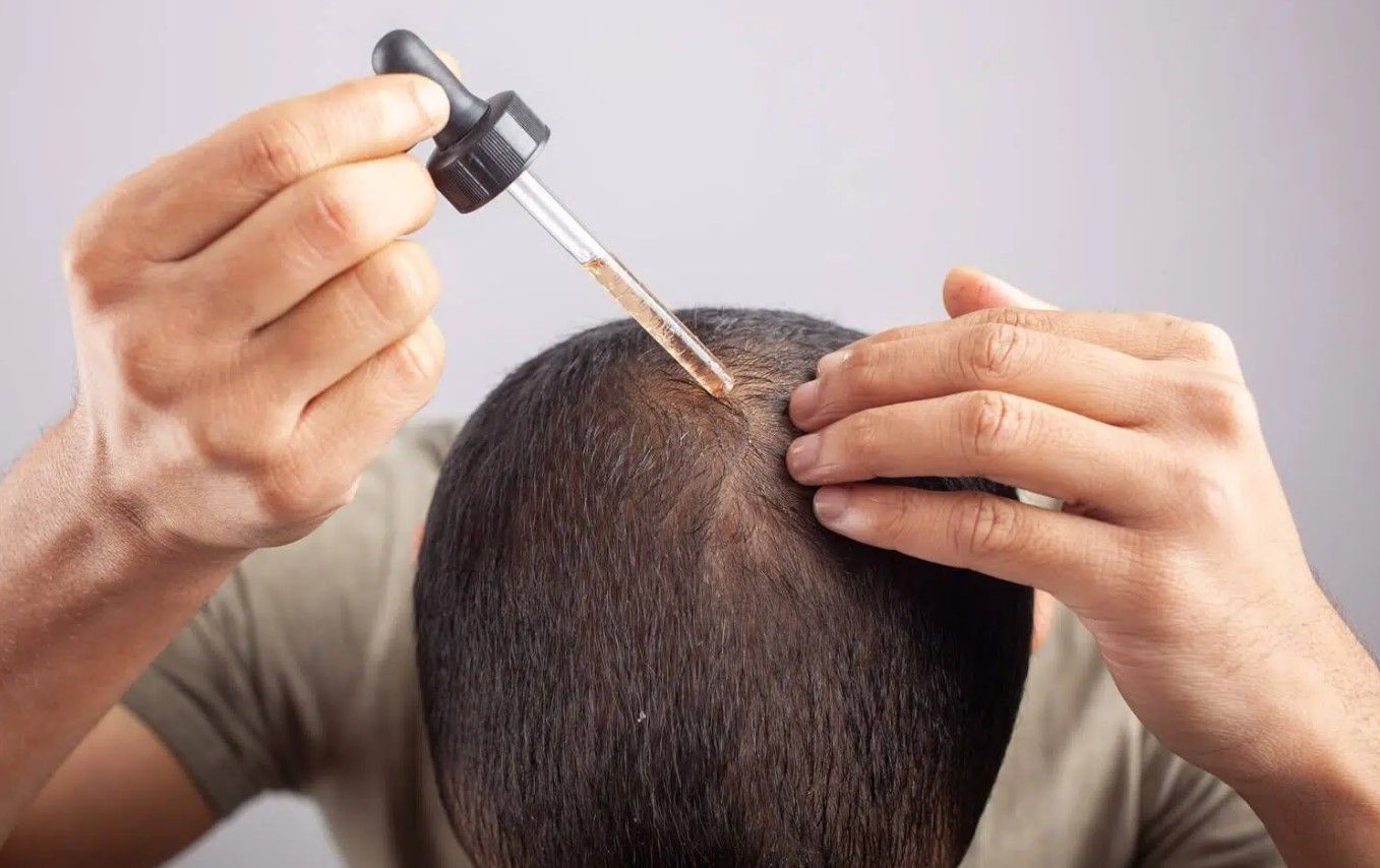 Sử dụng đúng liều lượng và kỹ thuật giúp Minoxidil thẩm thấu sâu vào da đầu để nuôi dưỡng nang tóc