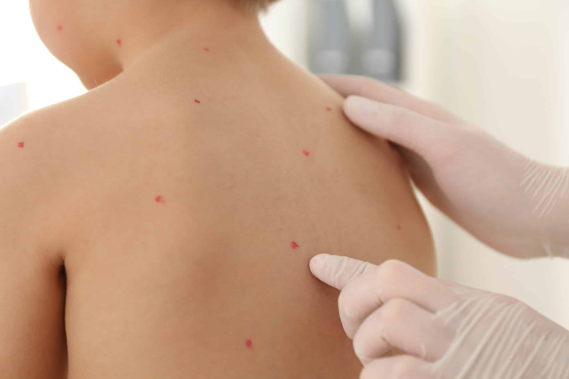 Các chấm đỏ nhỏ trên da có thể liên quan đến nhiều nguyên nhân khác nhau