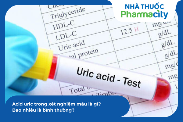 Xét nghiệm máu định kỳ giúp theo dõi và kiểm soát nồng độ acid uric ở mức an toàn