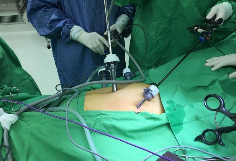 Trang thiết bị hiện đại đảm bảo tính an toàn cho quy trình nội soi
