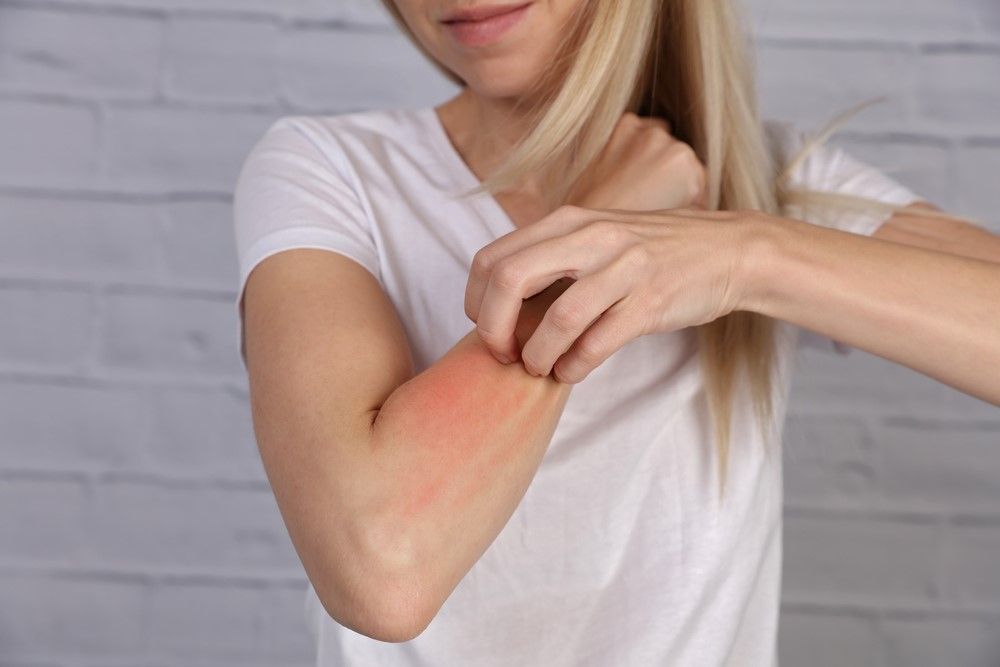 Hình minh họa bệnh lý Histoplasma