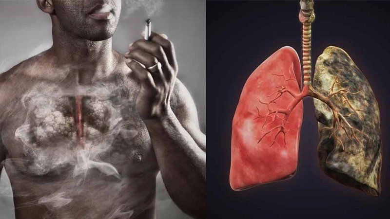 Thực hiện siêu âm định kỳ để theo dõi sức khoẻ gan